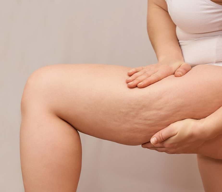 Read more about the article How To Lose Thigh Fat