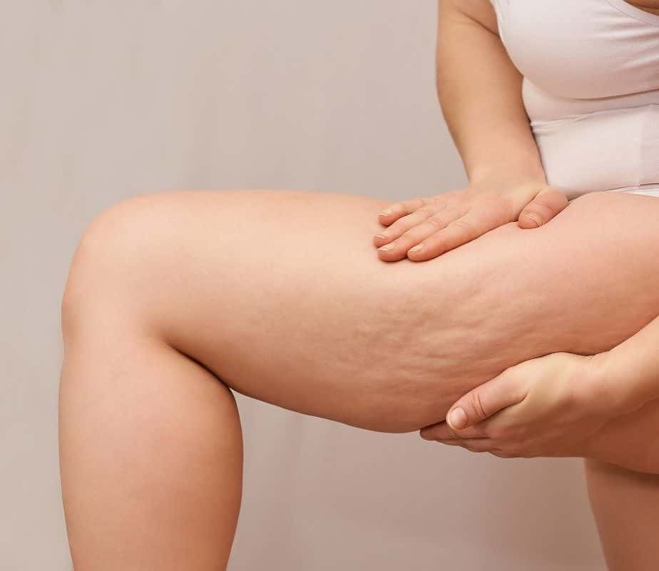 You are currently viewing How To Lose Thigh Fat